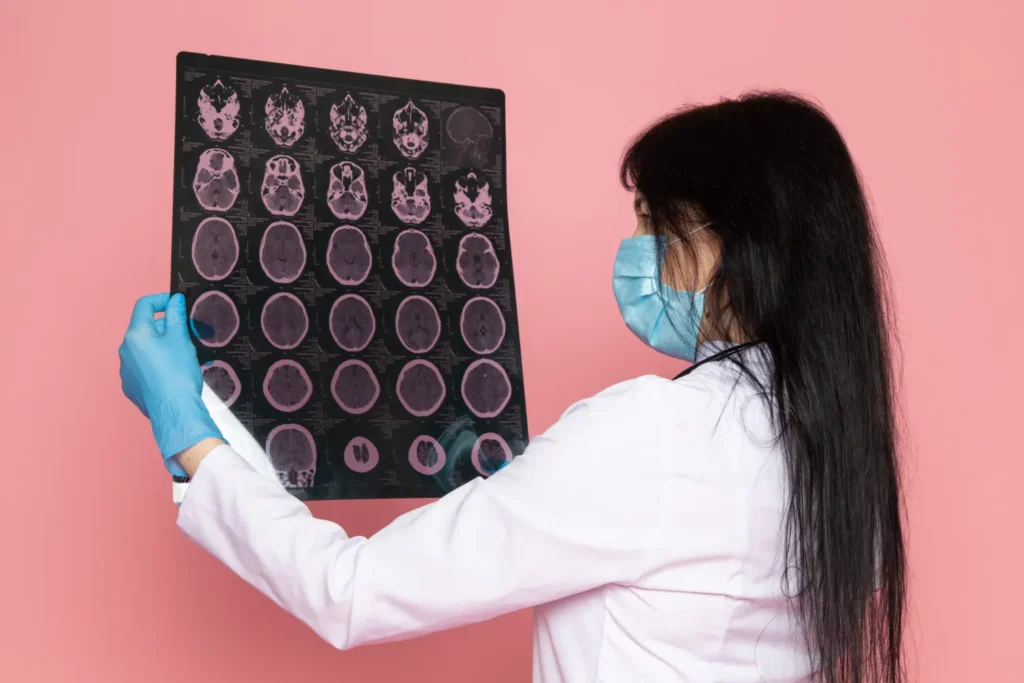 Médica avaliando se aneurisma cerebral tem curta